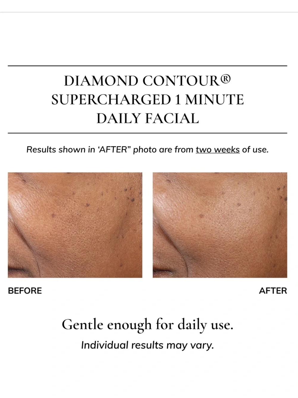Kaplan MD Diamond Contour Supercharged 1 Minute Daily Facial 6oz/180ml